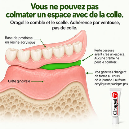 Oragel™ | Impedisce lo scivolamento della dentiera al 100% - Tenuta sicura per tutto il giorno