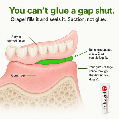 Oragel™ | Empêche les prothèses dentaires de glisser à 100 % - Fixation sûre toute la journée